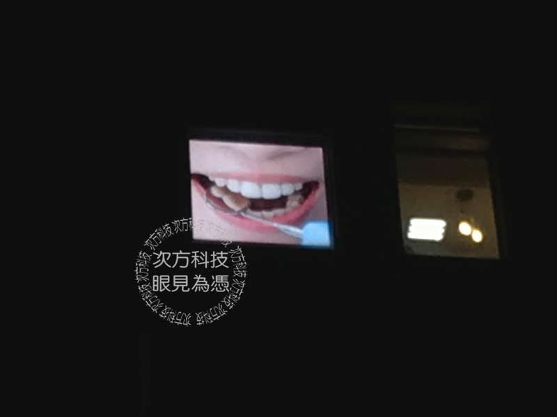 LED電視牆 新竹竹北 景觀牙醫